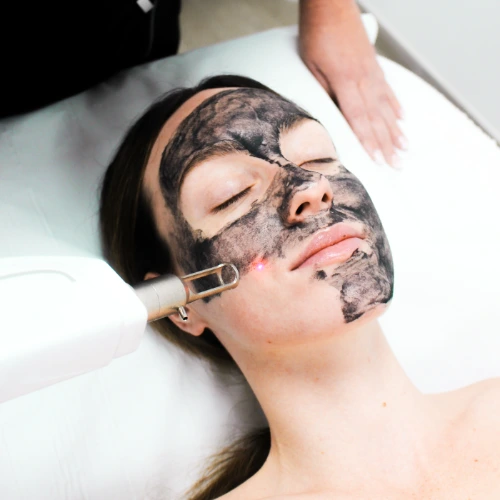 Láser Q-Switched – Hollywood Peel